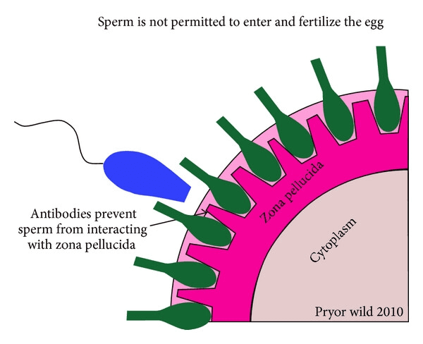 Alternate Picture Layout Image